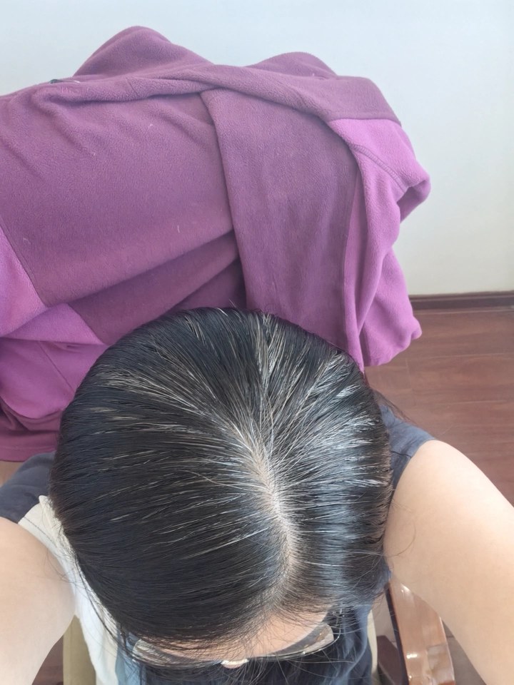 Moderate Gray before BioHueZ application