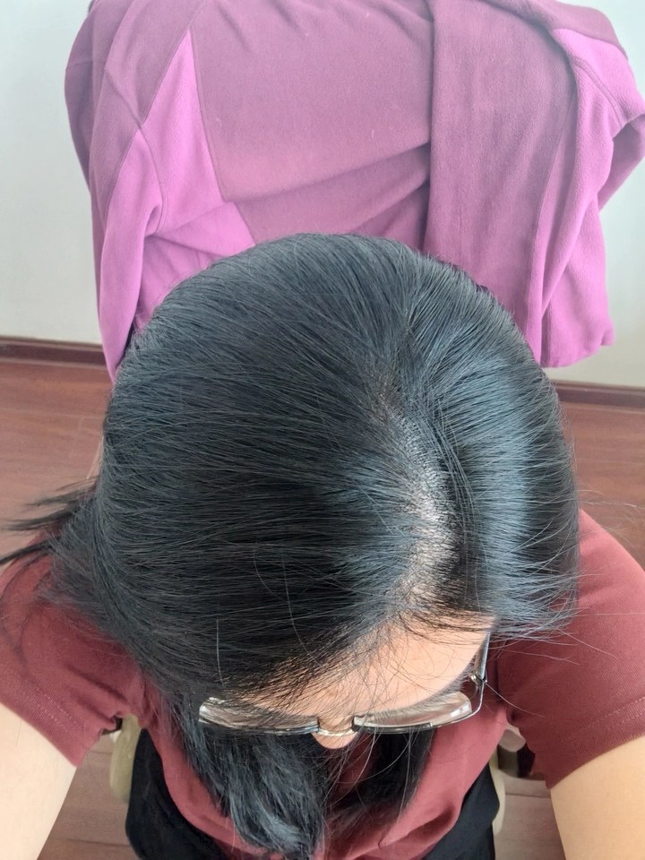 Moderate Gray after BioHueZ application